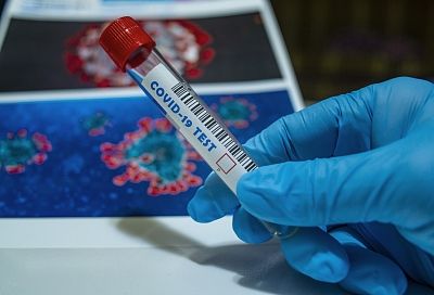 В Роспотребнадзоре оценили опасность нового штамма коронавируса   