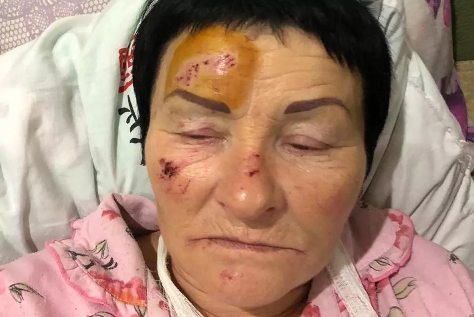 Пострадавшая женщина Пострадавшая женщина