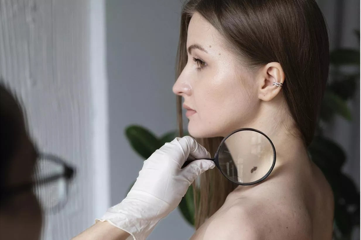 Солнце и рак: как избежать меланомы