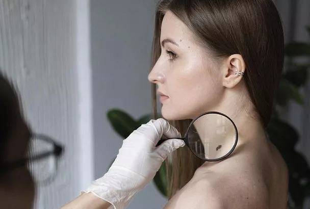 Солнце и рак: как избежать меланомы