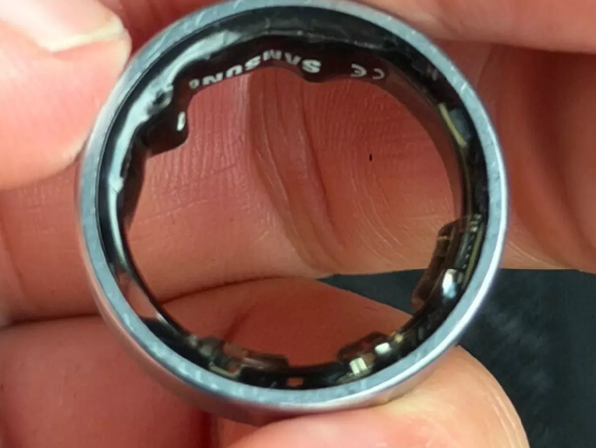 Вздувшаяся батарея умного кольца Galaxy Ring довела блогера до больницы