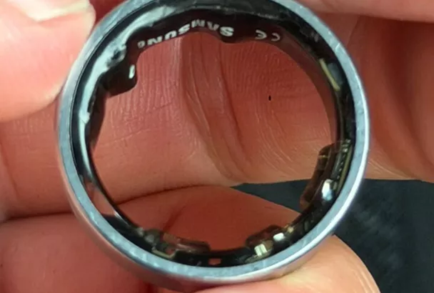 Вздувшаяся батарея умного кольца Galaxy Ring довела блогера до больницы