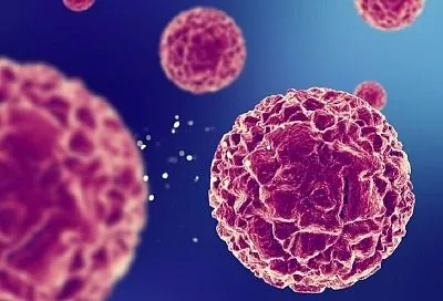 Онкология больше не приговор? Доктор рассказал о том, что изменится в медицине уже в 2025 году