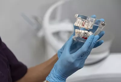 Российские ученые нашли способ снизить риск отторжения зубных имплантов