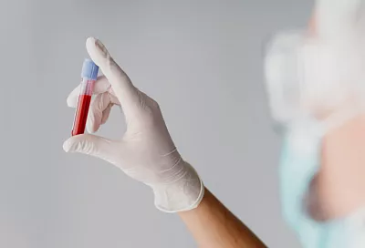 Стоимость общего анализа крови на Кубани выросла за год на 11%