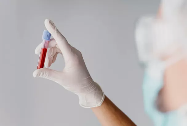 Стоимость общего анализа крови на Кубани выросла за год на 11%