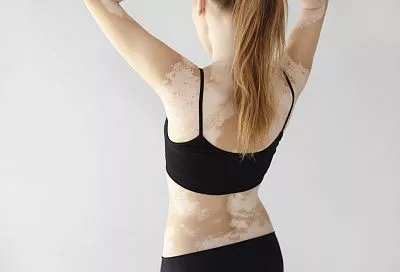 Это заболевание может появиться у каждого, но есть способы снизить риски