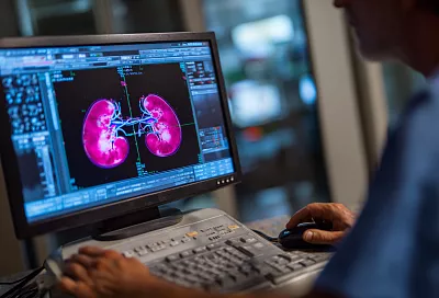 Как не допустить камни в почках: главный фактор и рабочие шаги