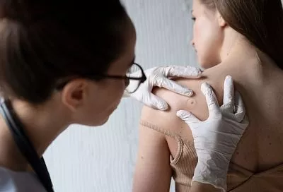 Маленькие и коварные: как уберечься от бородавок