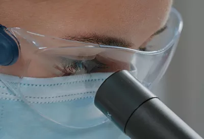 Российские ученые научились управлять иммунными клетками внутри опухоли с помощью лазера