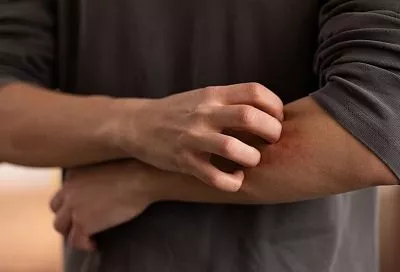 Тёплая весна пробудила слепней: кровососущие насекомые появились в Центральной России