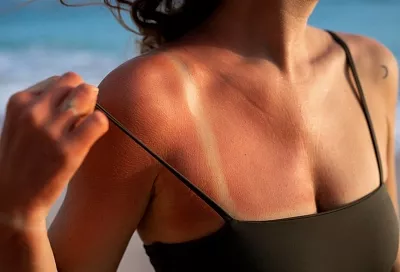 Солнце: друг или враг