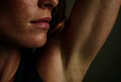 Папилломы исчезают за сутки? Эксперт рассказал, как убрать бородавки с помощью чеснока и йода