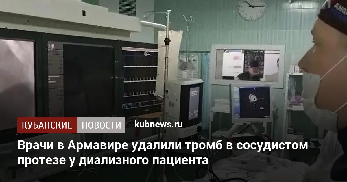 Врачи в Армавире удалили тромб в сосудистом протезе у диализного пациента