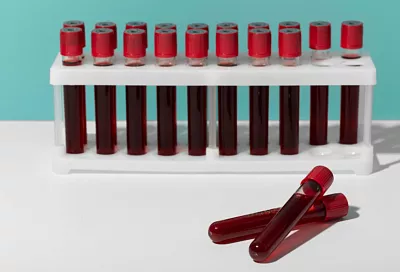 Ученые нашли «умное» антитело, которое не боится мутаций ВИЧ