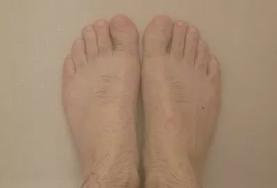 Вылечила грибок ногтей мужу, как советовала бабушка. Три проверенных способа из области народной медицины