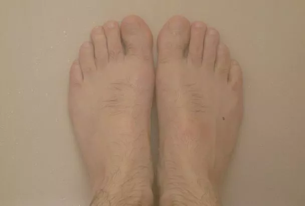 Вылечила грибок ногтей мужу, как советовала бабушка. Три проверенных способа из области народной медицины