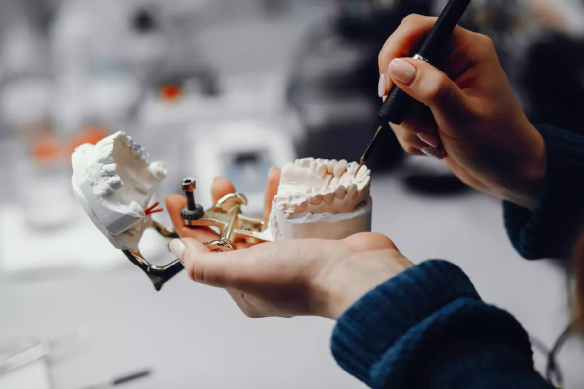 Ученые нашли способ сделать титановые зубные импланты прочнее и ускорить их срастание с костью