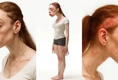 Лысые пятна и «ведьмин подбородок»: как будут выглядеть блогеры в 2050 году