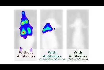 Ученые записали на видео, как коронавирус поражает организм