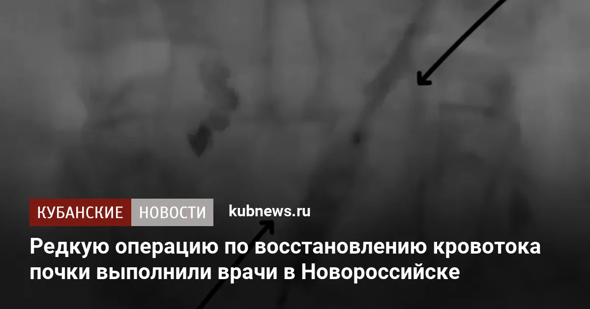 Редкую операцию по восстановлению кровотока почки выполнили врачи в Новороссийске