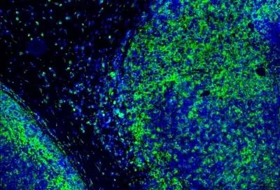 Новый флуоресцентный зонд для тубулина ускорит поиск новых противораковых препаратов