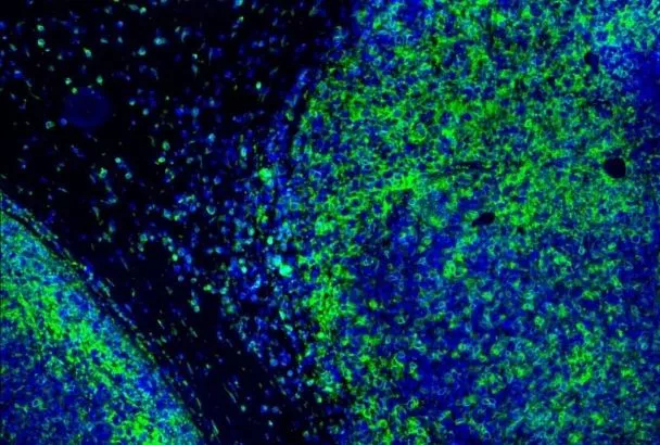 Новый флуоресцентный зонд для тубулина ускорит поиск новых противораковых препаратов