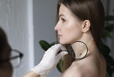 Солнце и рак: как избежать меланомы