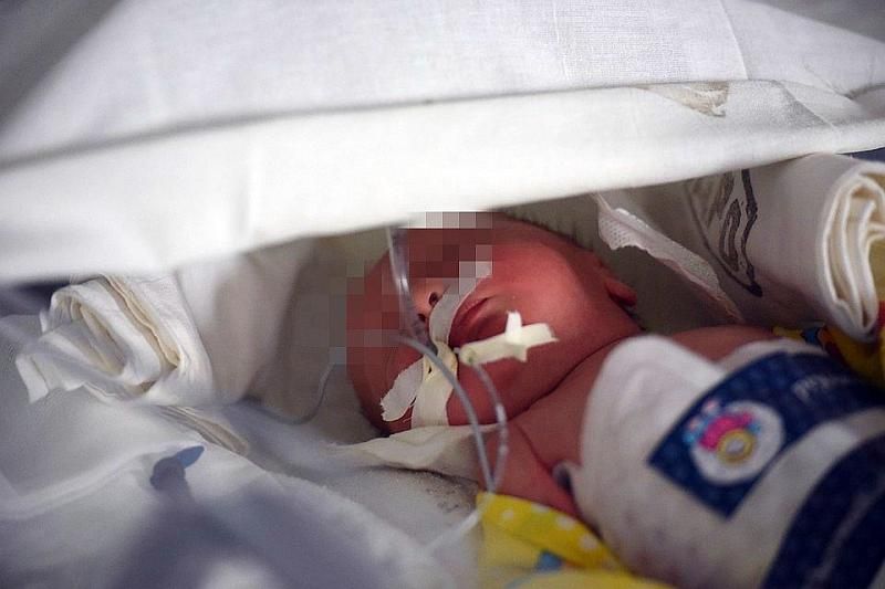 В Сочи от инсульта умер 2-месячный ребенок-маугли