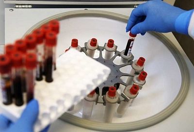 Жители Сочи смогут анонимно сдать тест на ВИЧ