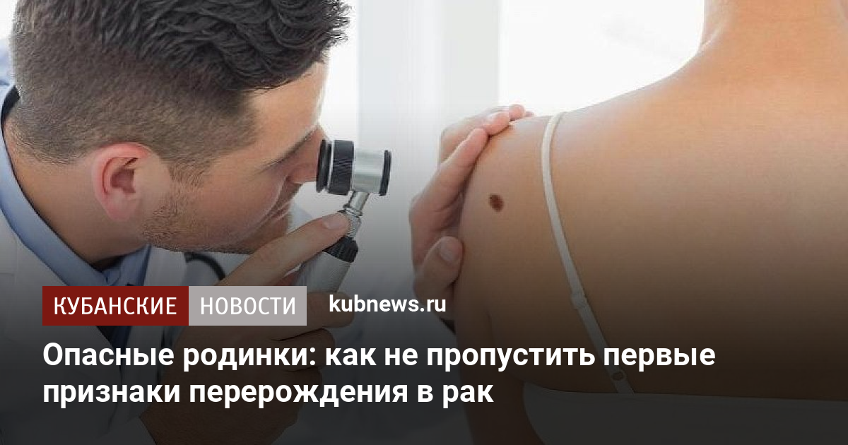 Проверить родинку на онкологию в красноярске по фото