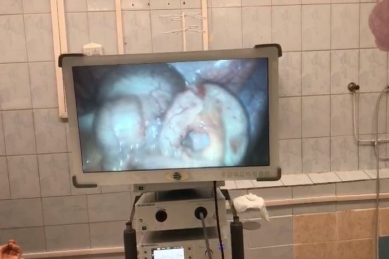 В Краснодаре врачи спасли 20-летнего пациента с зеркальными органами
