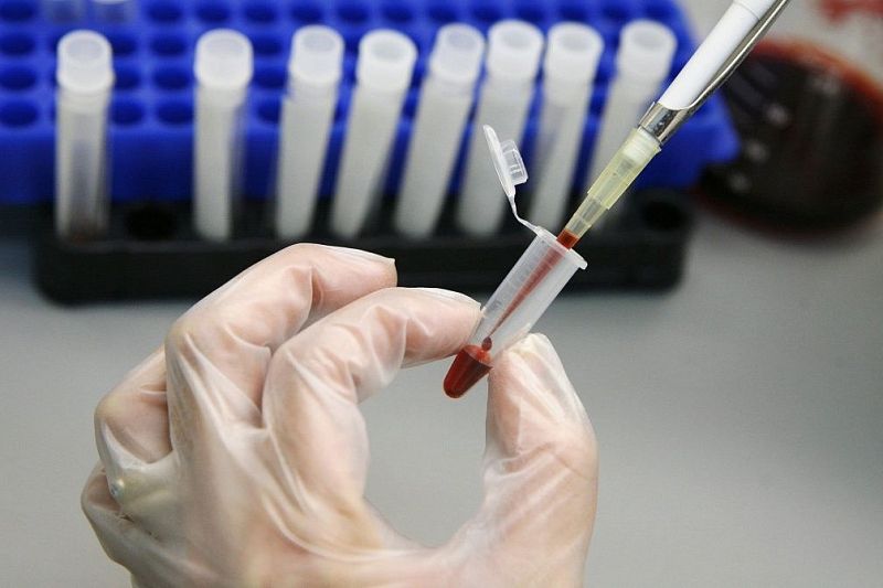 Ученые изобрели высокочувствительный к раку анализ крови