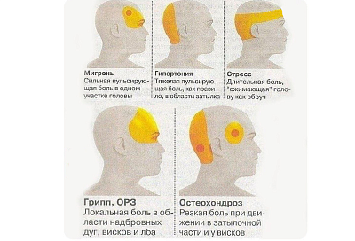 В каком месте болит голова: почему это так важно для вашего здоровья