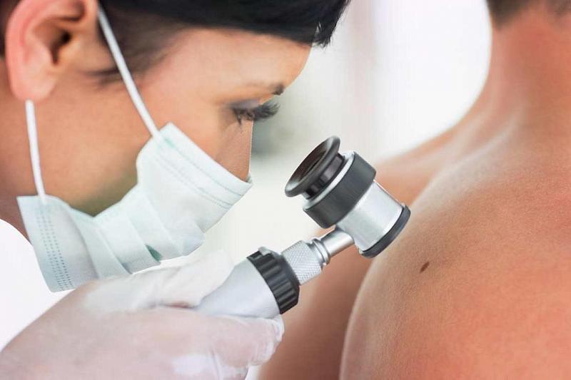 Рак кожи научились лечить вирусом герпеса