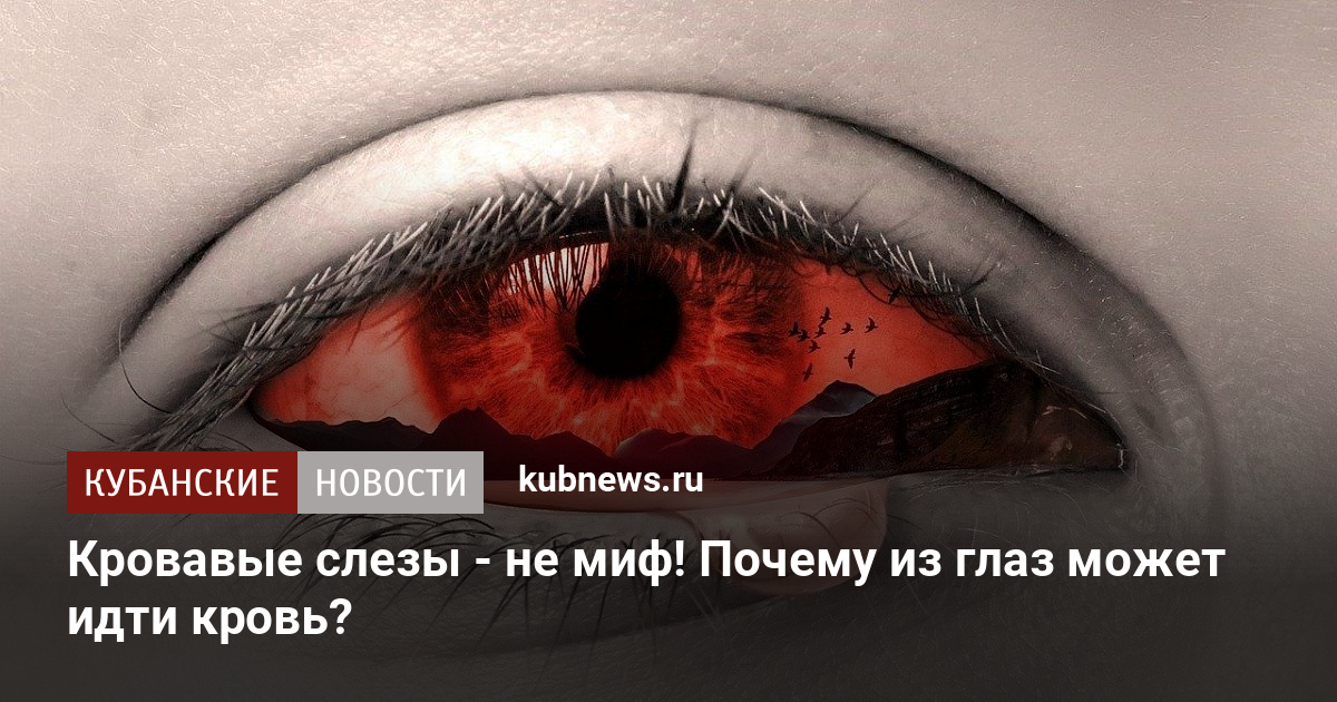 Ответы webmaster-korolev.ru: как сделать, что бы из глаз шла кровь (не много)