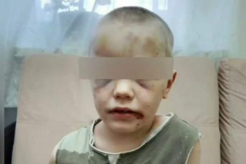 В одной из квартир Новороссийска нашли избитого 6-летнего мальчика-маугли