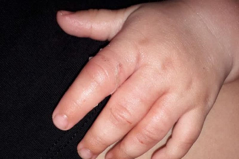 В Новороссийске ребенок засунул пальцы в сливное отверстие ванны и застрял