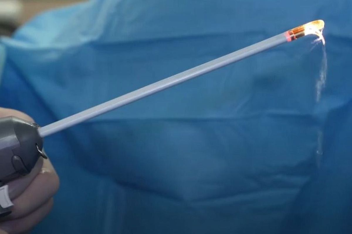 Новороссийские медики освоили передовую технологию для лечения аденомы простаты