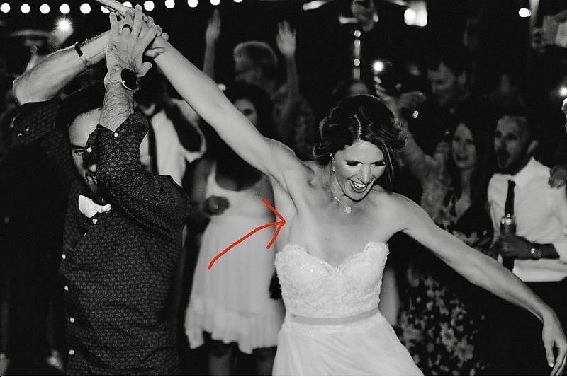 Невеста обнаружила у себя рак с помощью свадебных фото