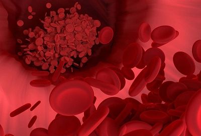 Какой способ разжижать кровь и растворять тромбы - самый эффективный?