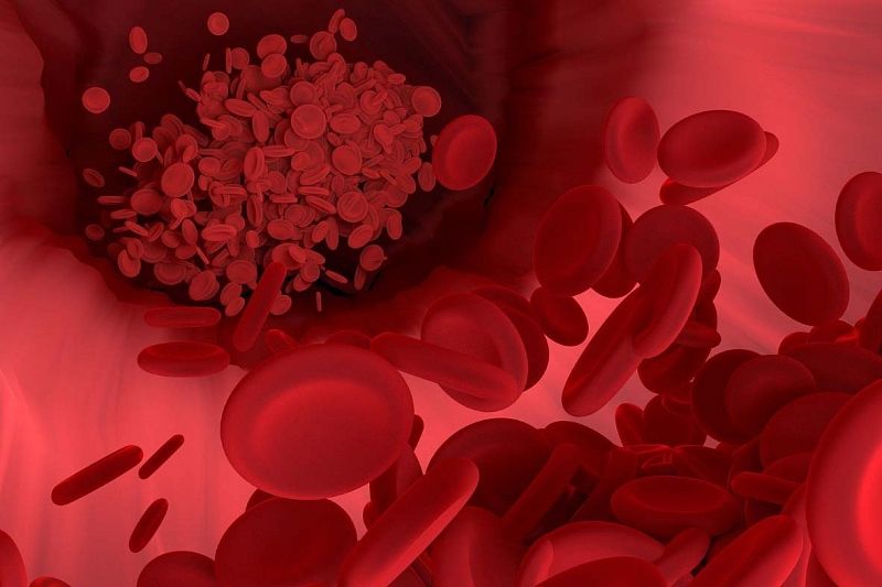 Какой способ разжижать кровь и растворять тромбы - самый эффективный?