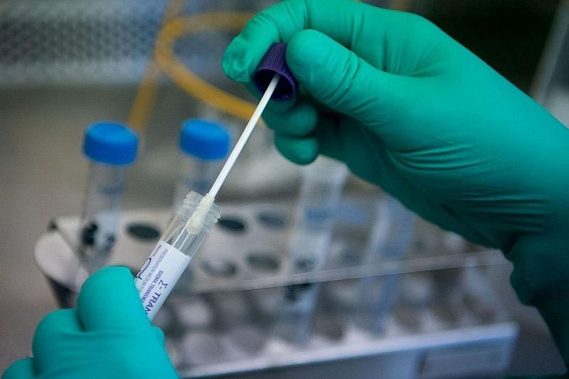Зарегистрирован первый в России экспресс-тест на антитела для привившихся от коронавируса