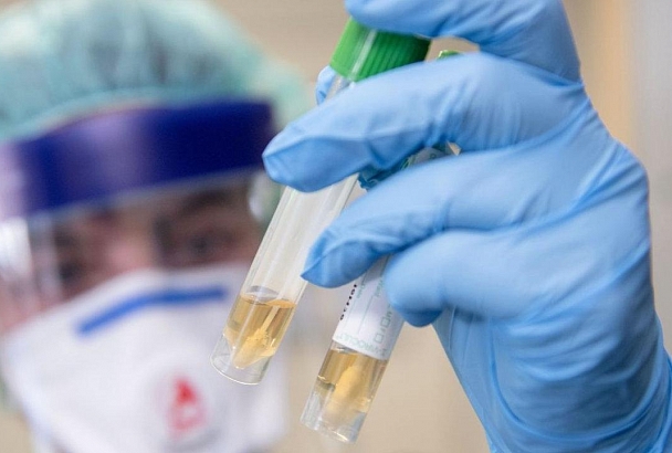В Краснодарском крае у 70 человек заподозрили коронавирус