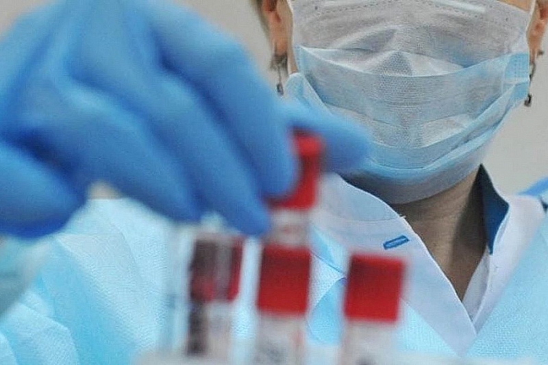 В Краснодарском крае на 31 марта новых случаев заболевания коронавирусом не выявлено