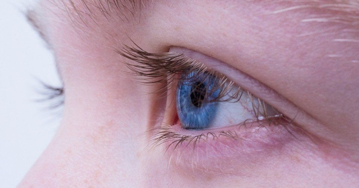Красные глаза: лечение и профилактика