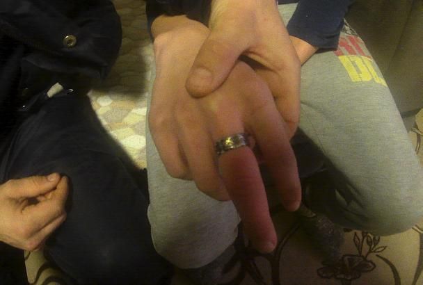 В Краснодарском крае подростку пришлось вызывать спасателей, чтобы снять кольцо с пальца