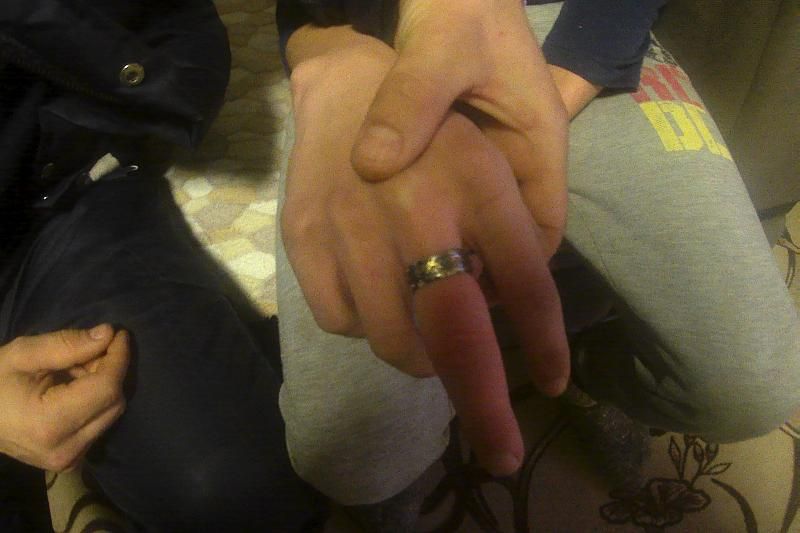 В Краснодарском крае подростку пришлось вызывать спасателей, чтобы снять кольцо с пальца