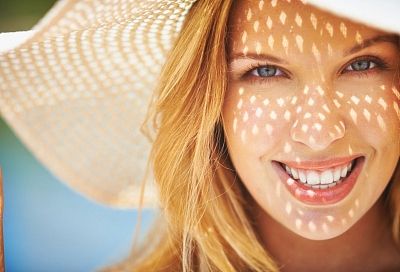 Спасение найдете в кружке: как защитить кожу лица от обгорания на солнце