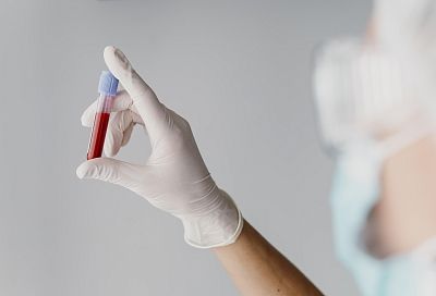 Никогда не сдавайте их: пять бесполезных анализов крови, которые вам могут навязать врачи